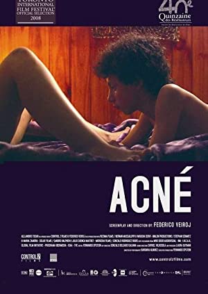 Acne 720p Erotik Film +18 izle